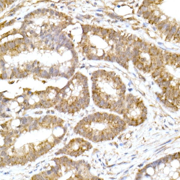 ACAT1 Rabbit monoclonal antibody