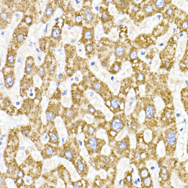 ACAT1 Rabbit monoclonal antibody