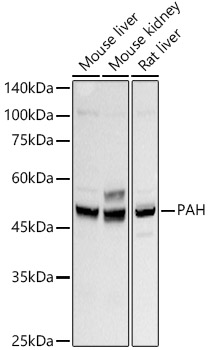 PAH Rabbit monoclonal antibody