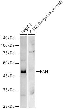 PAH Rabbit monoclonal antibody