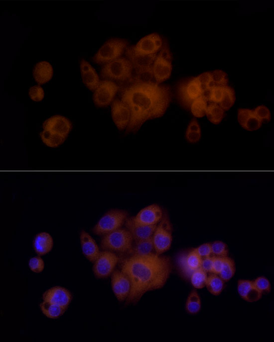 PAH Rabbit monoclonal antibody
