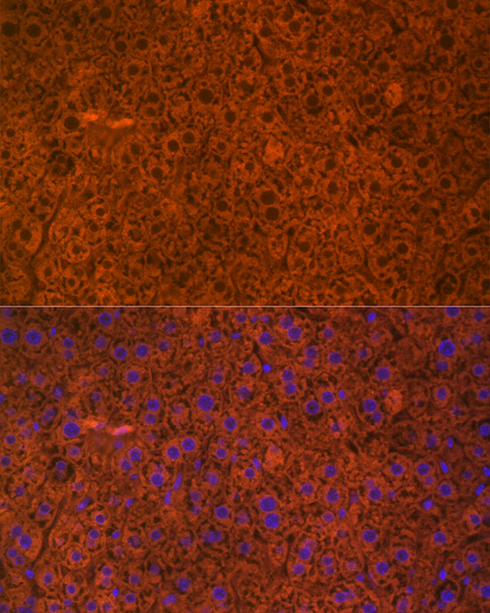 PAH Rabbit monoclonal antibody