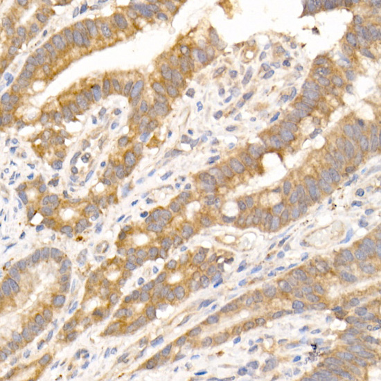 NUDT19 Rabbit monoclonal antibody