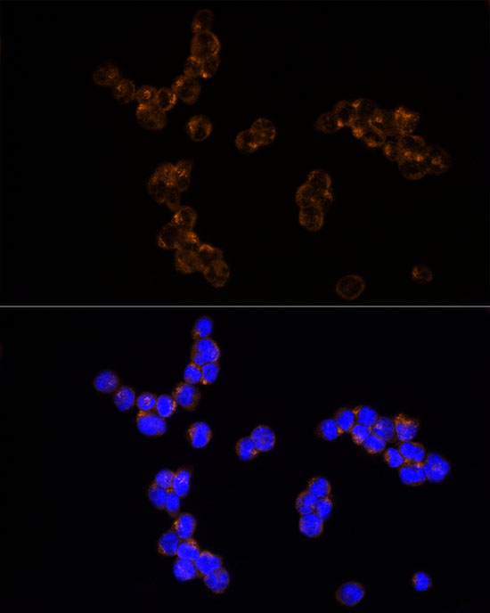 NUDT19 Rabbit monoclonal antibody