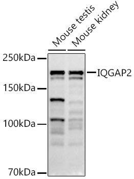 IQGAP2 Rabbit monoclonal antibody