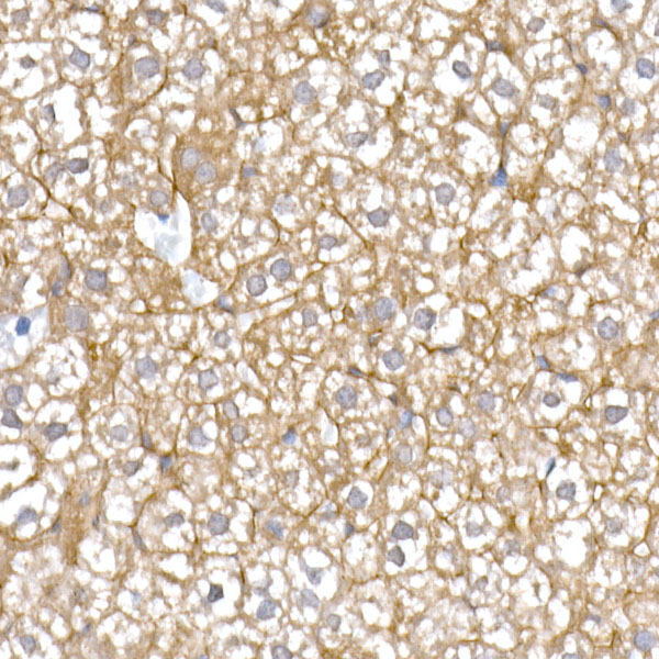 IQGAP2 Rabbit monoclonal antibody