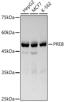 PREB Rabbit monoclonal antibody