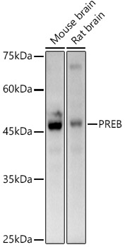 PREB Rabbit monoclonal antibody