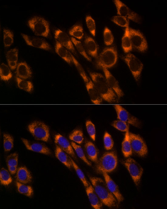 PREB Rabbit monoclonal antibody