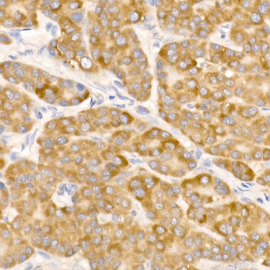 ATP5G1 Rabbit monoclonal antibody
