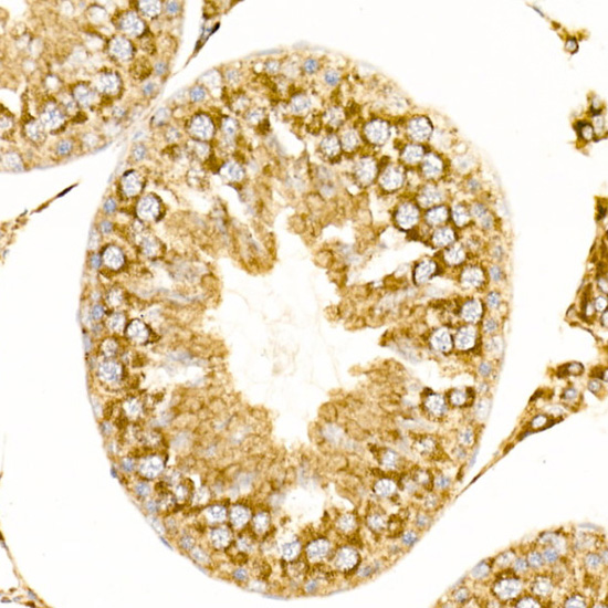 ATP5G1 Rabbit monoclonal antibody
