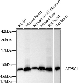ATP5G1 Rabbit monoclonal antibody