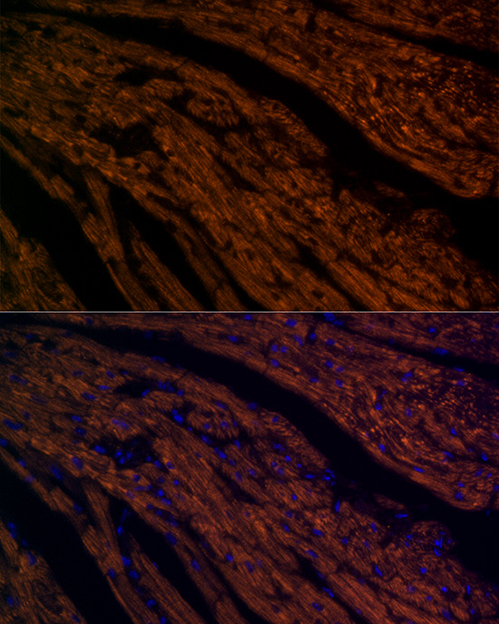 ATP5G1 Rabbit monoclonal antibody