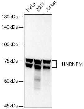 HNRNPM Rabbit monoclonal antibody