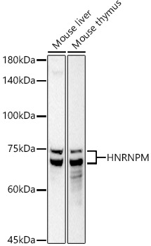 HNRNPM Rabbit monoclonal antibody