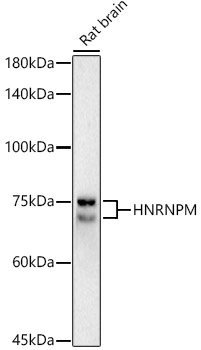 HNRNPM Rabbit monoclonal antibody