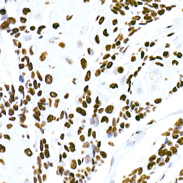 HNRNPM Rabbit monoclonal antibody