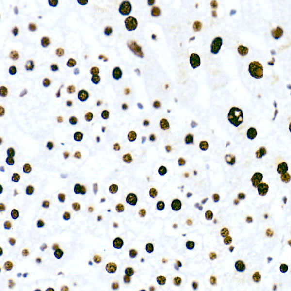 HNRNPM Rabbit monoclonal antibody