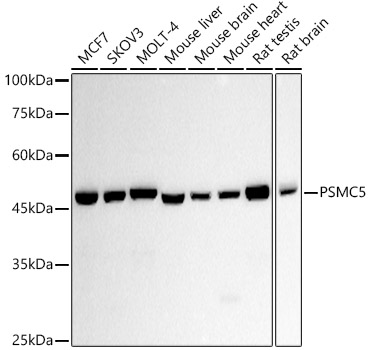 PSMC5 Rabbit monoclonal antibody