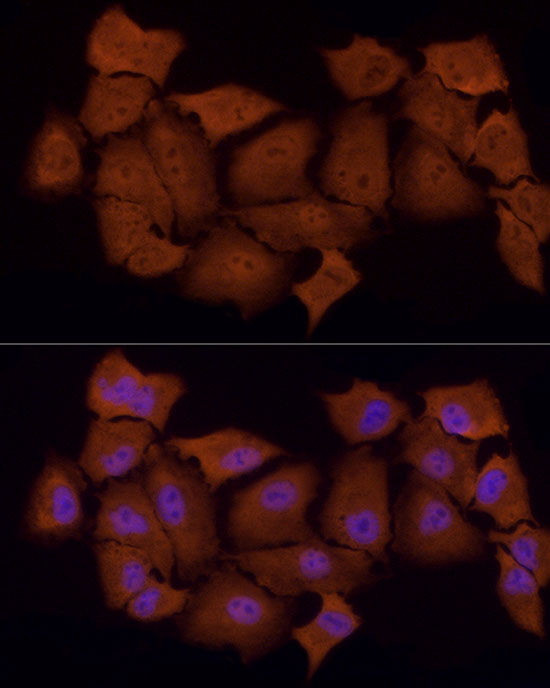PSMC5 Rabbit monoclonal antibody
