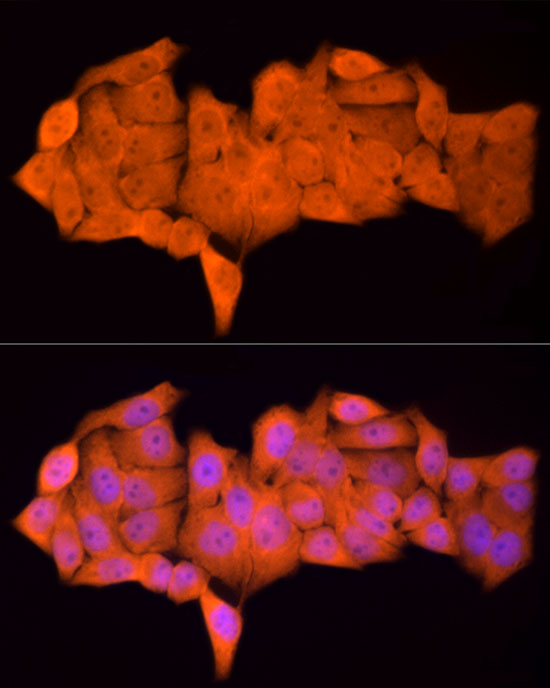 PSMC5 Rabbit monoclonal antibody