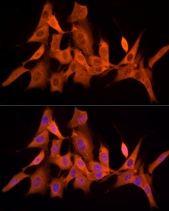 PSMC5 Rabbit monoclonal antibody