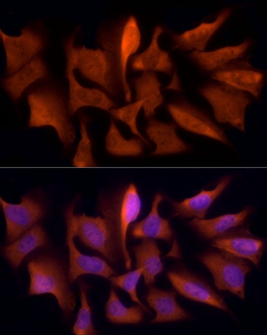 PSMC5 Rabbit monoclonal antibody