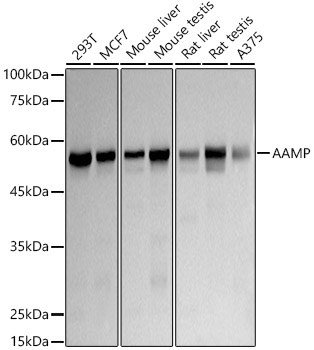 AAMP Rabbit monoclonal antibody