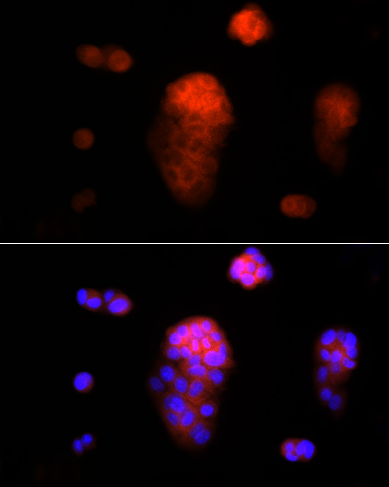 AAMP Rabbit monoclonal antibody