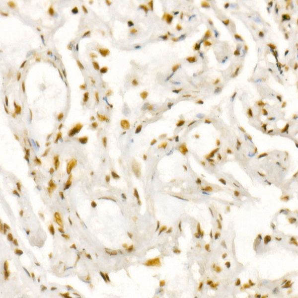 DAZAP1 Rabbit monoclonal antibody