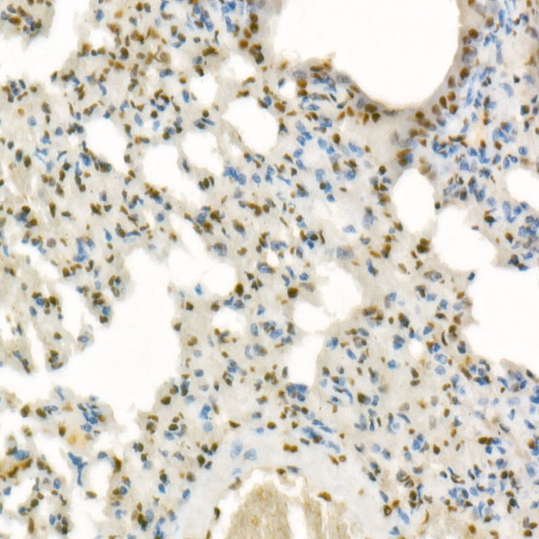 DAZAP1 Rabbit monoclonal antibody