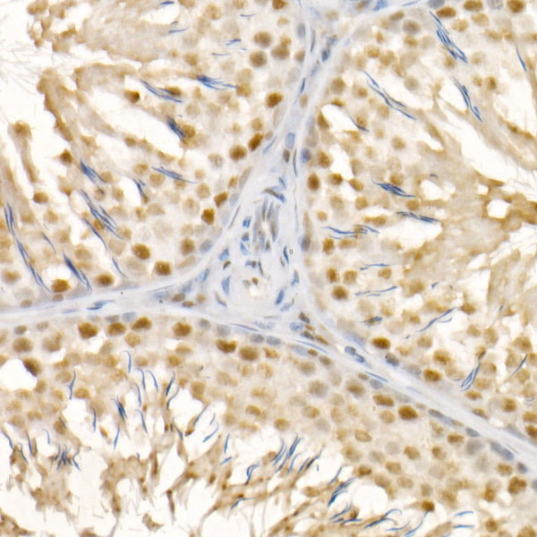 DAZAP1 Rabbit monoclonal antibody