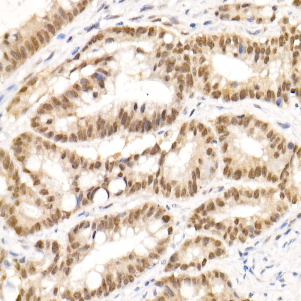 TCEA1 Rabbit monoclonal antibody