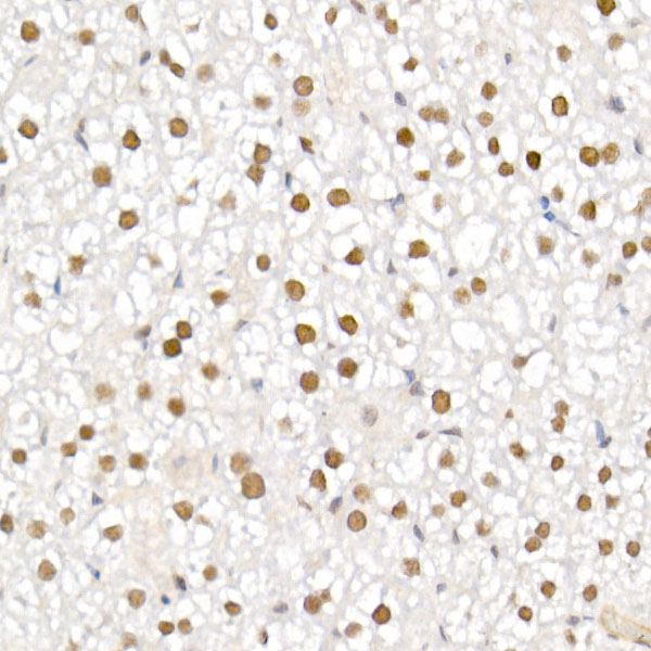 TCEA1 Rabbit monoclonal antibody
