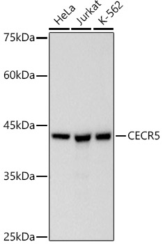 CECR5 Rabbit monoclonal antibody