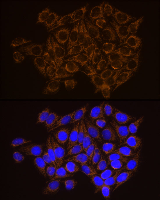 CECR5 Rabbit monoclonal antibody