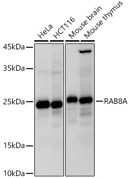 RAB8A Rabbit monoclonal antibody