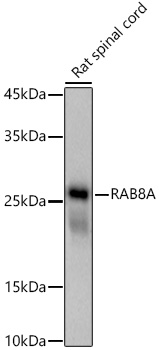 RAB8A Rabbit monoclonal antibody