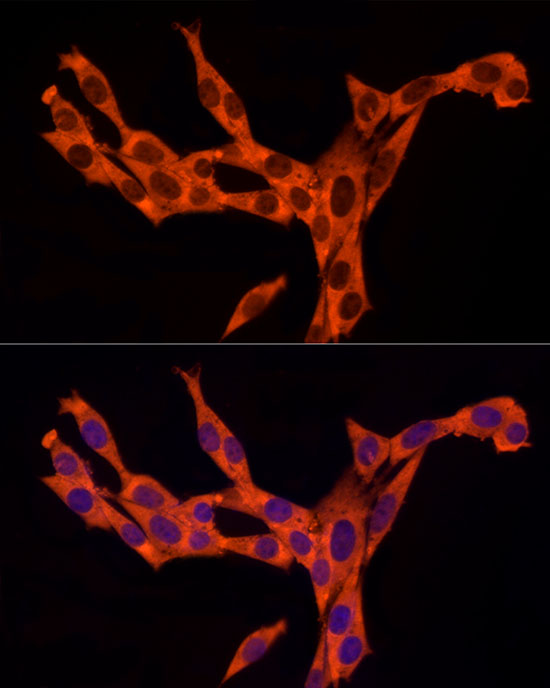 RAB8A Rabbit monoclonal antibody