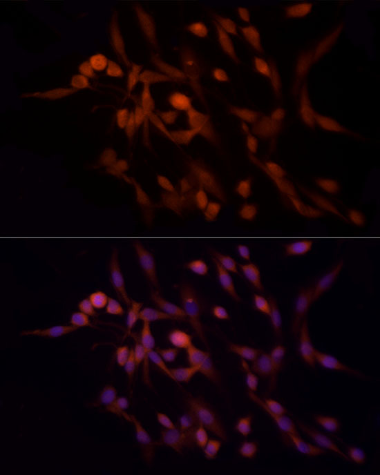 RAB8A Rabbit monoclonal antibody