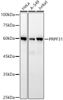 PRPF31 Rabbit mAb