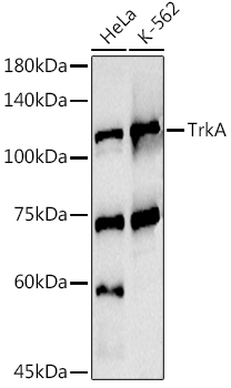 TrkA Rabbit polyclonal antibody
