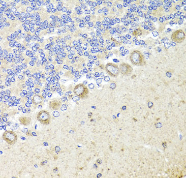 TrkA Rabbit polyclonal antibody
