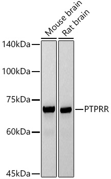 PTPRR Rabbit mAb