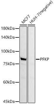 PFKP Rabbit monoclonal antibody