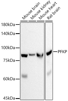 PFKP Rabbit monoclonal antibody