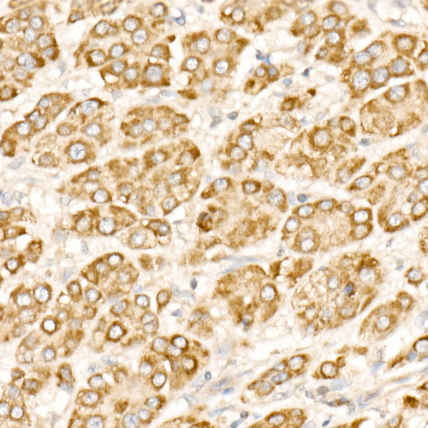 PFKP Rabbit monoclonal antibody