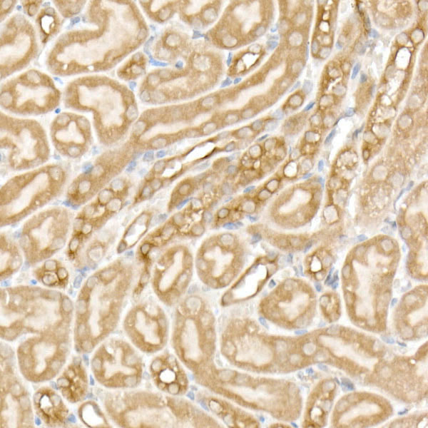 PFKP Rabbit monoclonal antibody