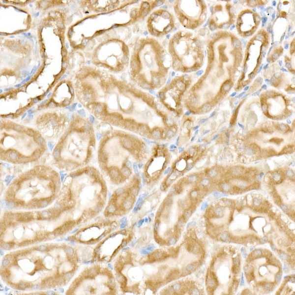 PFKP Rabbit monoclonal antibody
