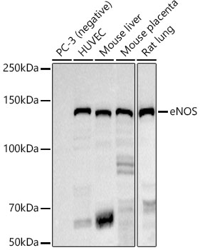 eNOS Rabbit monoclonal antibody